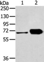 Anti-DPYSL5 antibody