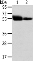 Anti-SLC1A1 antibody