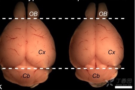 如上图所示, 请问怎样拍摄新鲜小鼠脑组织或者固定后脑组织整体照片的