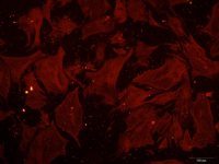 小鼠胰腺星状细胞