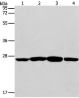 Anti-CASP14 antibody