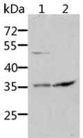 Anti-SOCS1 antibody