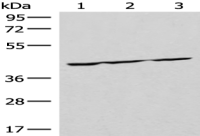 Anti-SLC16A7 antibody