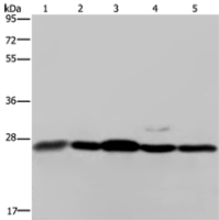 Anti-HMGB1 antibody