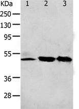 Anti-F2R antibody