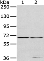Anti-MMP24 antibody
