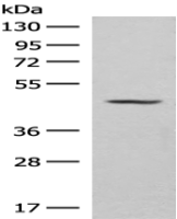 Anti-SLC16A14 antibody