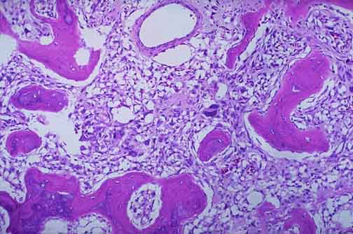 人甲状腺癌组织源细胞细胞培养试剂盒【Human Cancer PrimacellTM：Breast Cancer Tissues Cells】说明书