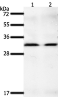 Anti-GEMIN2 antibody