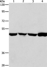 Anti-ING1 antibody