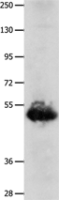 Anti-BPIFB3 antibody