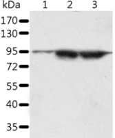 Anti-SPATA20 antibody