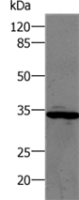 Anti-CA1 antibody