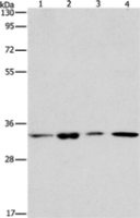 Anti-ARPC2 antibody
