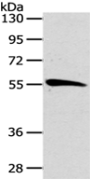 Anti-CDC25A antibody