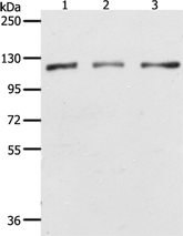 Anti-PARP1 antibody