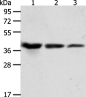 Anti-ANXA1 antibody