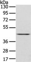 Anti-DLK1 antibody