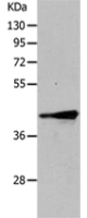 Anti-TRIM63 antibody