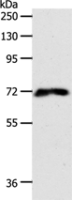 Anti-FZD1 antibody