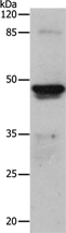 Anti-KRT15 antibody