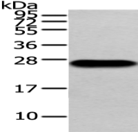 Anti-Lambda Light chain antibody