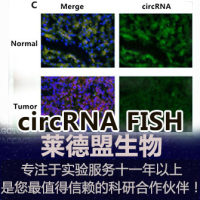 circRNA FISH检测(环状RNA)