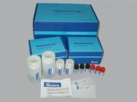 超敏可溶性白介素6（人）德国DRG试剂盒原装进口