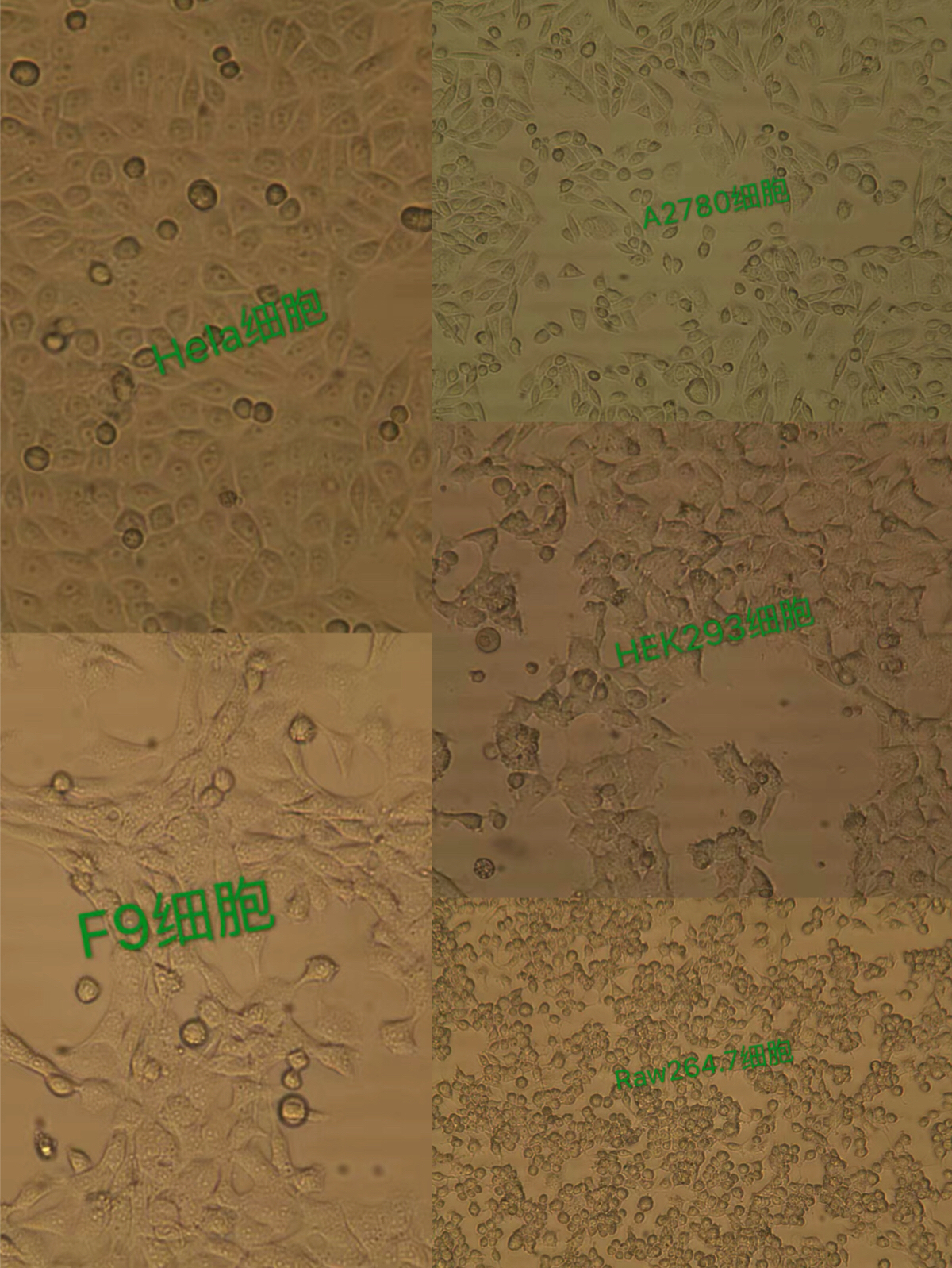 P31/FUJ细胞，急性髓性白血病细胞