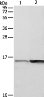Anti-PFN1 antibody