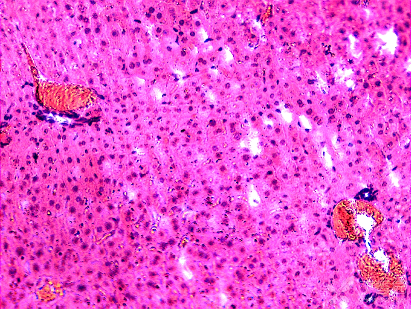 求助!小鼠肝組織病理切片,不知道什麼原因,看不太清細胞