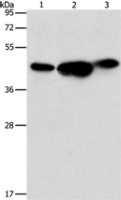 Anti-ARFGAP1 antibody