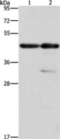 Anti-ACTA1 antibody