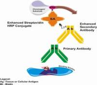 中杉金桥SP-9002小鼠SP试剂盒(小鼠链霉卵白素-生物素法检测系统) SP-9002 SPlink Detection Kits (Biotin-Streptavidin HRP Detection Systems)