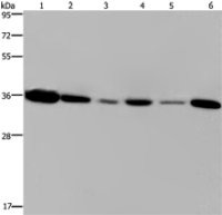Anti-EMD antibody