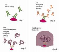 中杉金桥PK-4002小鼠ABC Kit