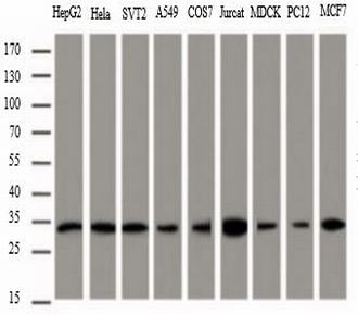 中杉金桥TA-13Mouse Anti-PCNA mAb产品图
