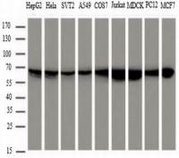 中杉金桥TA-14Mouse Anti-HSP60 (HSPD1) mAb