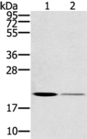 Anti-RBBP9 antibody