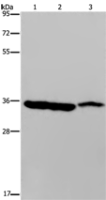 Anti-MDH1 antibody