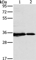 Anti-NDUFAF1 antibody