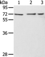 Anti-RBBP5 antibody