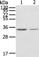 Anti-GNB2L1 antibody