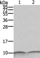 Anti-S100A6 antibody