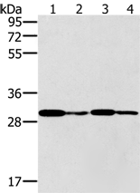Anti-PNMT antibody