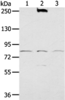 Anti-NOX5 antibody