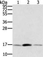 Anti-PPIA antibody