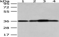 Anti-STX12 antibody