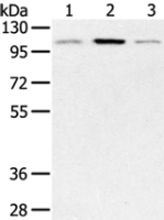 Anti-PYGM antibody