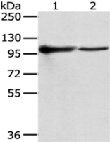 Anti-TPX2 antibody